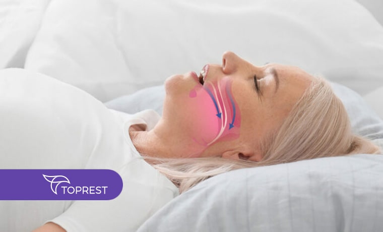 آپنه خواب چیست؟